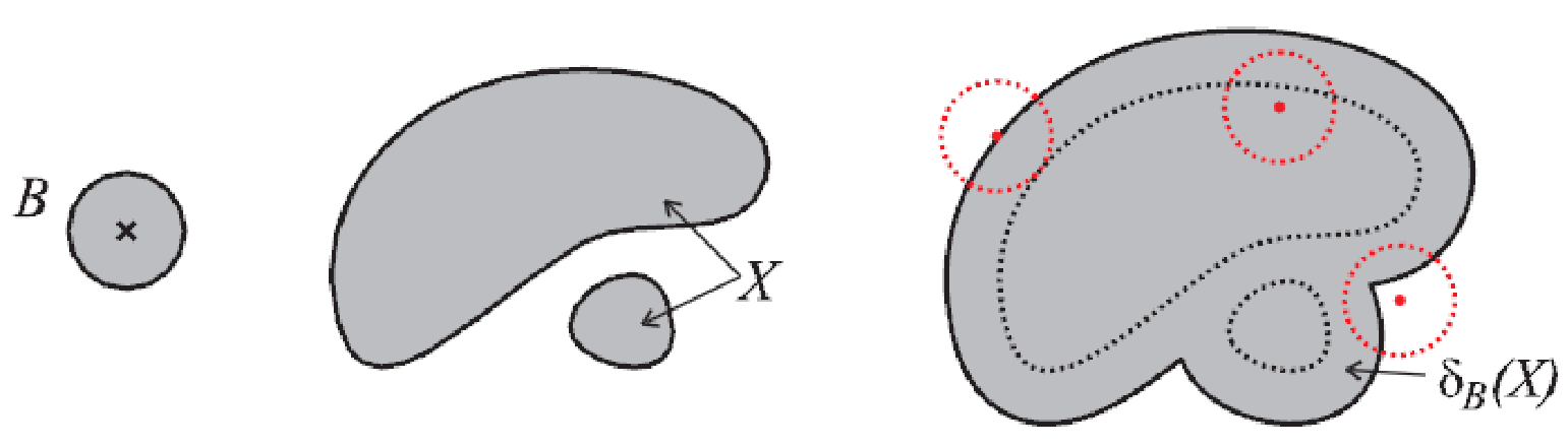 szp10 dilation